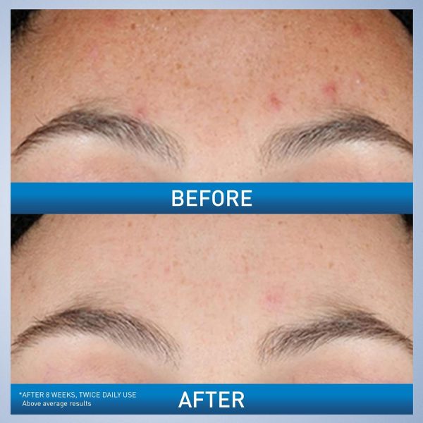 Resurfacing Serum